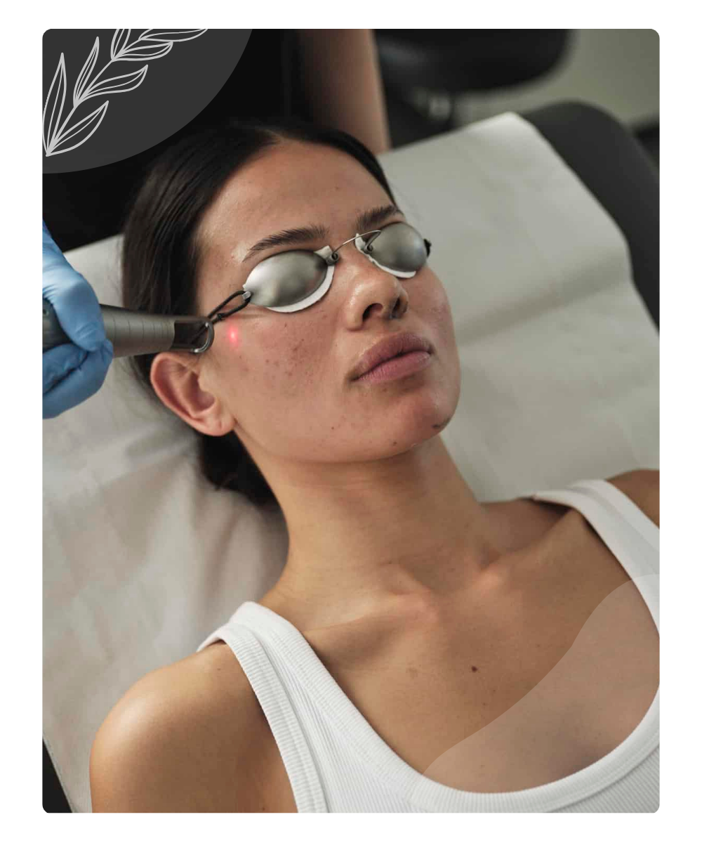 Nd Yag Laser